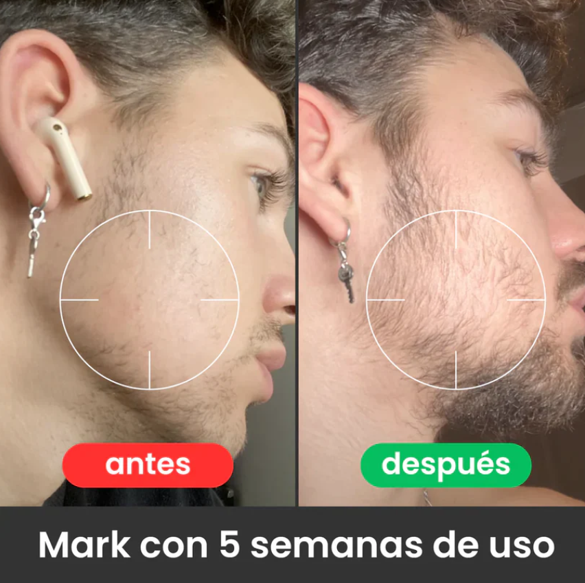 Shampoo en barra-HairRevive® OFERTA 2X1