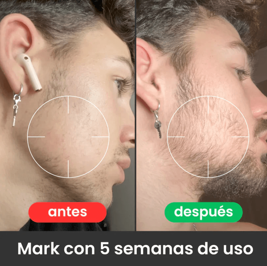 Shampoo en barra-HairRevive® OFERTA 2X1